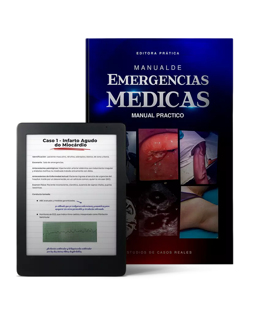 ▷ Utilidad del protocolo E-FAST en la Medicina de Urgencias y Emergencias -  Ocronos - Editorial Científico-Técnica